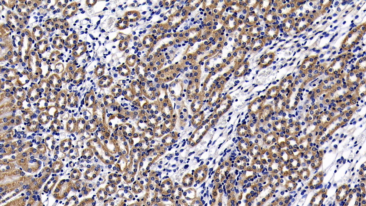 Lymphocyte Antigen 96 (LY96) Human Polyclonal Antibody