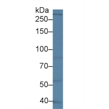Leucine Rich Repeat Kinase 2 (LRRK2) Human Polyclonal Antibody