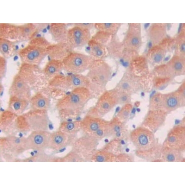 Leucine Rich Repeat Kinase 2 (LRRK2) Human Polyclonal Antibody