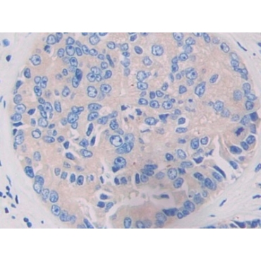 Leucine Rich Repeat In FLII Interacting Protein 1 (LRRFIP1) Human Polyclonal Antibody