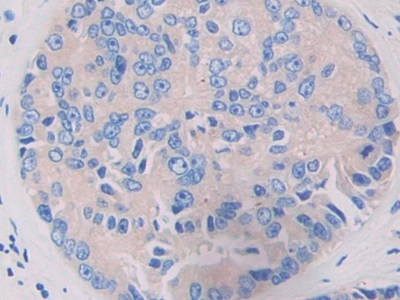 Leucine Rich Repeat In FLII Interacting Protein 1 (LRRFIP1) Human Polyclonal Antibody