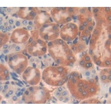Lymphocyte Adaptor Protein (Lnk) Mouse Polyclonal Antibody