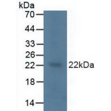 V-Ki-Ras2 Kirsten Rat Sarcoma Viral Oncogene Homolog (KRAS) Human Polyclonal Antibody
