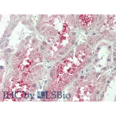 Klotho Beta (KLb) Human Polyclonal Antibody