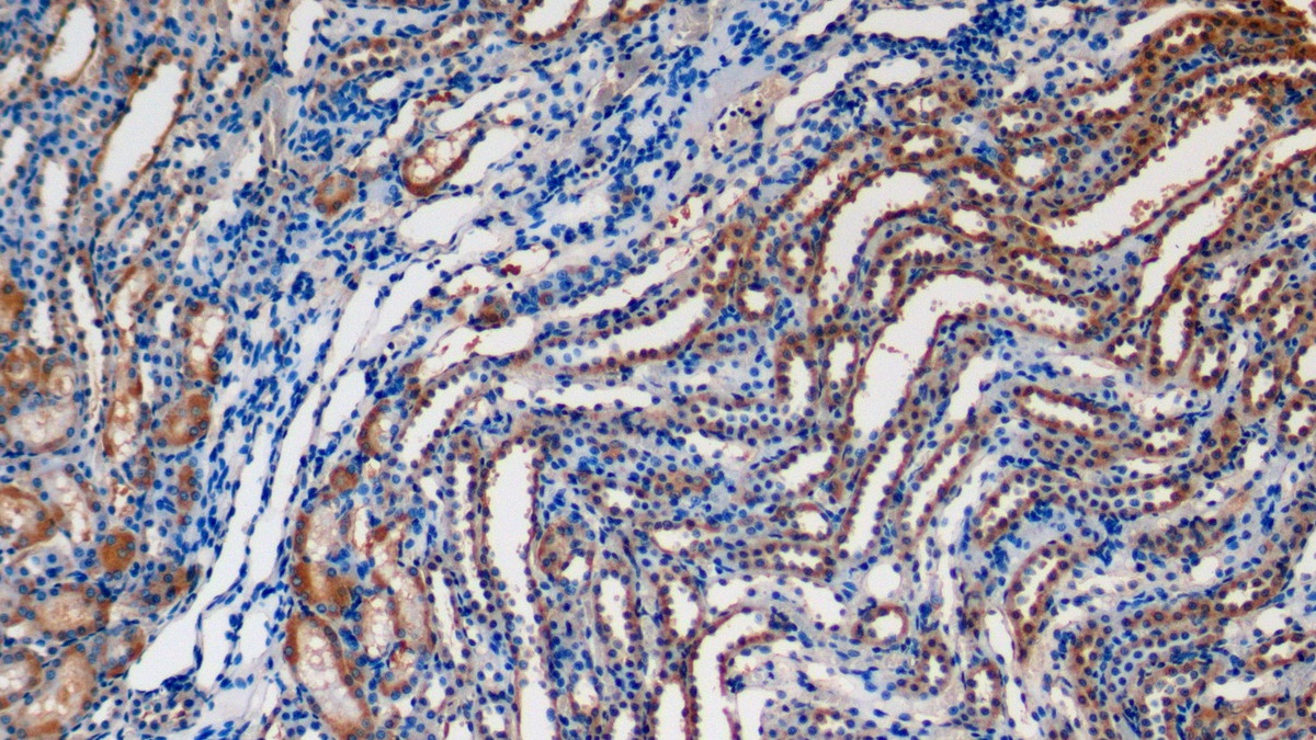 Klotho (KL) Rat Polyclonal Antibody