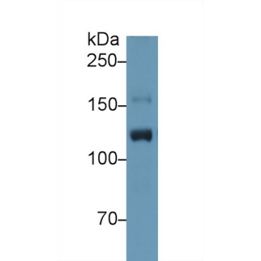 Inter Alpha-Globulin Inhibitor H4 (ITIH4) Human Polyclonal Antibody