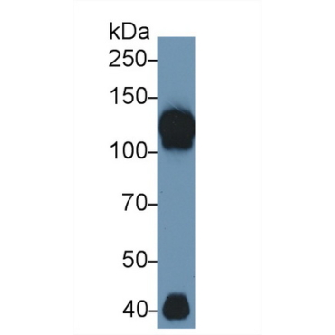Inter Alpha-Globulin Inhibitor H4 (ITIH4) Human Polyclonal Antibody
