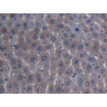 Inter Alpha-Globulin Inhibitor H4 (ITIH4) Mouse Polyclonal Antibody