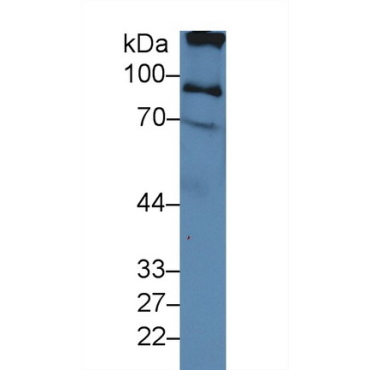 Inter Alpha-Globulin Inhibitor H2 (ITIH2) Human Polyclonal Antibody