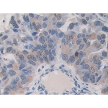Inter Alpha-Globulin Inhibitor H1 (ITIH1) Human Polyclonal Antibody