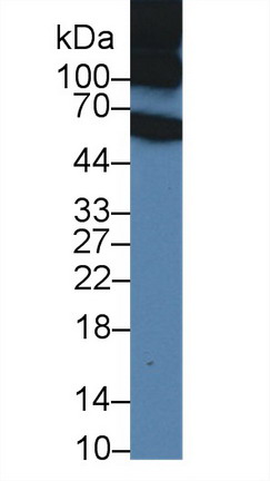 Inter Alpha-Globulin Inhibitor H1 (ITIH1) Rat Polyclonal Antibody