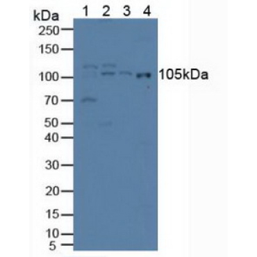 Iron Responsive Element Binding Protein 2 (IREB2) Human Polyclonal Antibody
