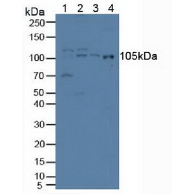 Iron Responsive Element Binding Protein 2 (IREB2) Human Polyclonal Antibody