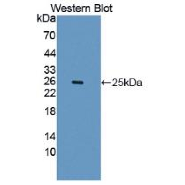 Interleukin 1 Receptor Accessory Protein Like Protein 1 (IL1RAPL1) Human Polyclonal Antibody