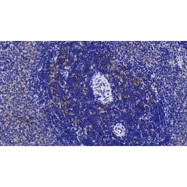 Interleukin 1 Receptor Accessory Protein (IL1RAP) Human Polyclonal Antibody