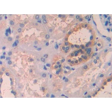 Interleukin 1 Receptor Accessory Protein (IL1RAP) Human Polyclonal Antibody