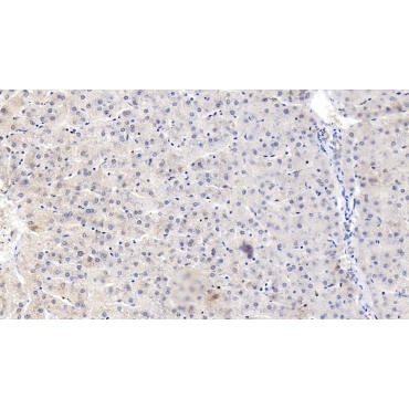 Interleukin 18 Binding Protein (IL18BP) Human Polyclonal Antibody