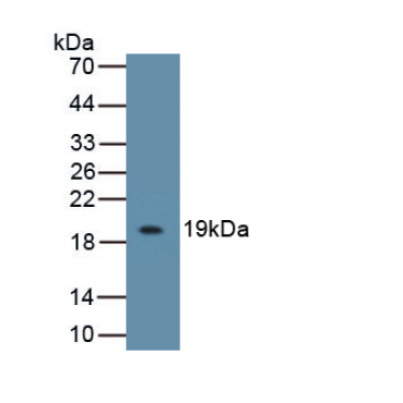 Interleukin 18 Binding Protein (IL18BP) Mouse Polyclonal Antibody