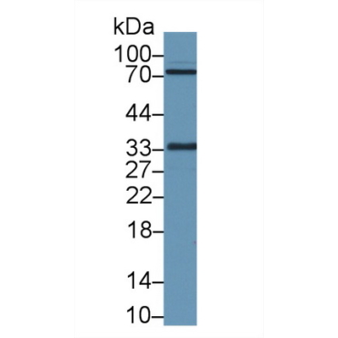 Exosome Component 2 (EXOSC2) Human Polyclonal Antibody