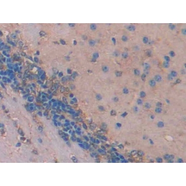 Iduronate-2-Sulfatase (IDS) Mouse Polyclonal Antibody