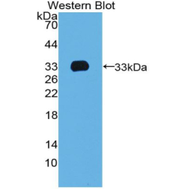 T-Box Protein 4 (TBX4) Human Polyclonal Antibody