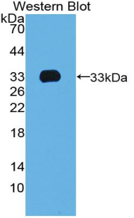 T-Box Protein 4 (TBX4) Human Polyclonal Antibody