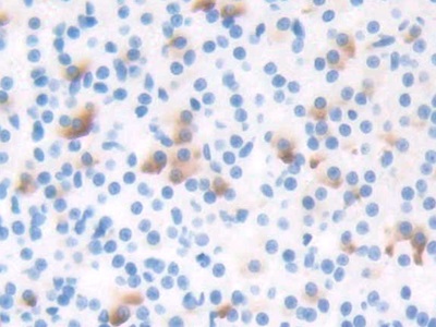 T-Box Protein 3 (TBX3) Rat Polyclonal Antibody