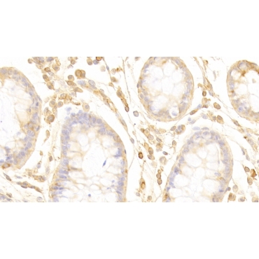 Pleckstrin Homology Domain Containing Family A, Member 1 (PLEKHA1) Human Polyclonal Antibody