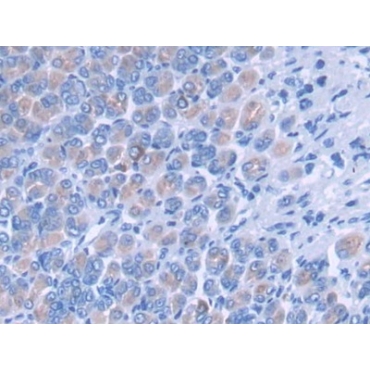 Pleckstrin Homology Domain Containing Family A, Member 1 (PLEKHA1) Mouse Polyclonal Antibody