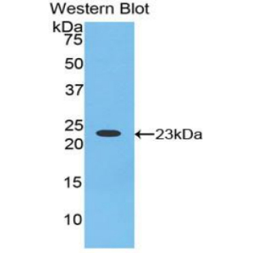 Hornerin (HRNR) Human Polyclonal Antibody