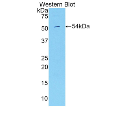 Hepatocyte Growth Factor Activator (HGFAC) Mouse Polyclonal Antibody