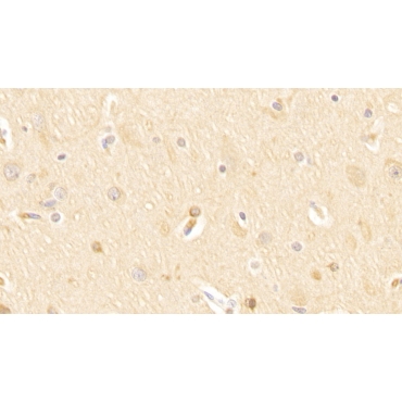 Huntingtin Associated Protein 1 (HAP1) Human Polyclonal Antibody