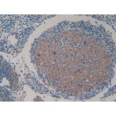 Huntingtin Associated Protein 1 (HAP1) Mouse Polyclonal Antibody