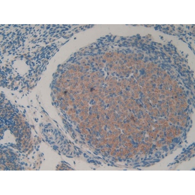 Huntingtin Associated Protein 1 (HAP1) Mouse Polyclonal Antibody