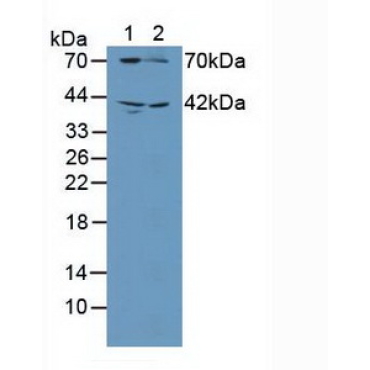 Guanylate Cyclase 1 Beta 3 (GUCY1b3) Human Polyclonal Antibody