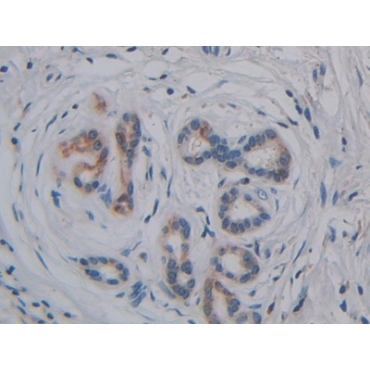 Glycosylphosphatidylinositol Specific Phospholipase D1 (GPLD1) Human Polyclonal Antibody