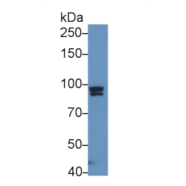 Glycerol-3-Phosphate Acyltransferase, Mitochondrial (GPAM) Human Polyclonal Antibody