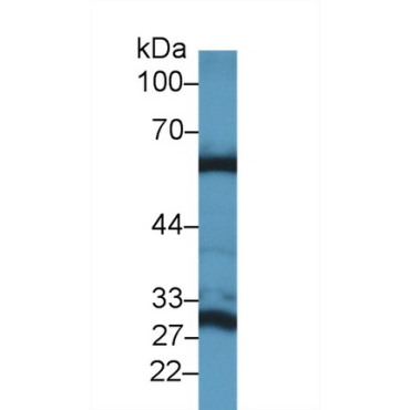 Glutaminase 2 (GLS2) Mouse Polyclonal Antibody