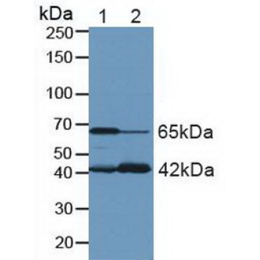 Glutaminase (GLS) Human Polyclonal Antibody