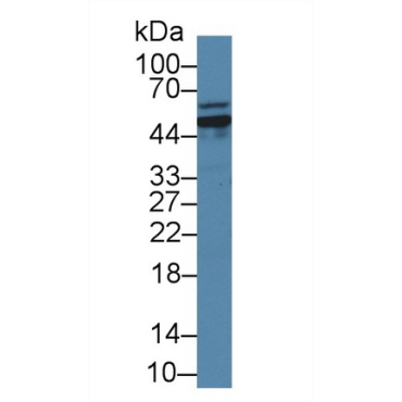 Glutaminase (GLS) Mouse Polyclonal Antibody