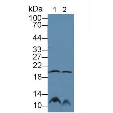 Gastrokine 2 (GKN2) Human Polyclonal Antibody