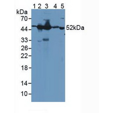 Guanine Deaminase (GDA) Human Polyclonal Antibody
