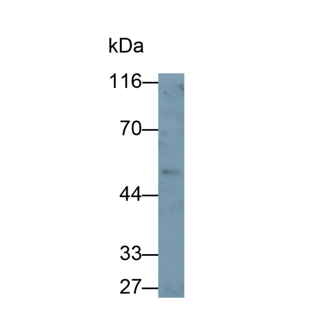Galactose-3-O-Sulfotransferase 1 (GAL3ST1) Human Polyclonal Antibody