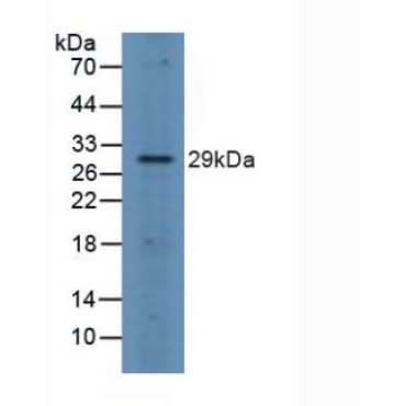FOS Like Antigen 1 (FOSL1) Human Polyclonal Antibody