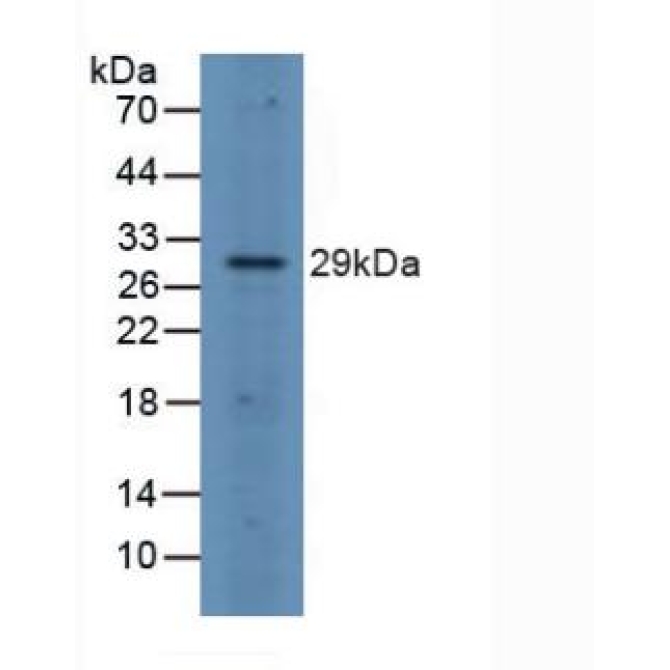FOS Like Antigen 1 (FOSL1) Human Polyclonal Antibody
