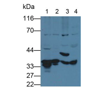 Fructosamine-3-Kinase (FN3K) Human Polyclonal Antibody