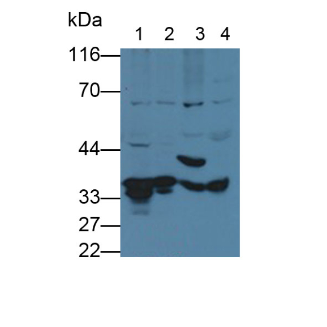 Fructosamine-3-Kinase (FN3K) Human Polyclonal Antibody