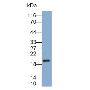 Filaggrin (FLG) Human Polyclonal Antibody