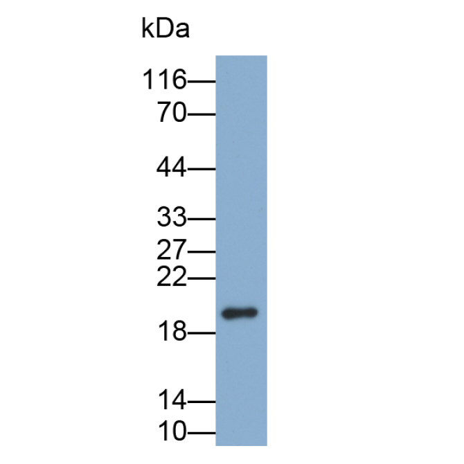 Filaggrin (FLG) Human Polyclonal Antibody