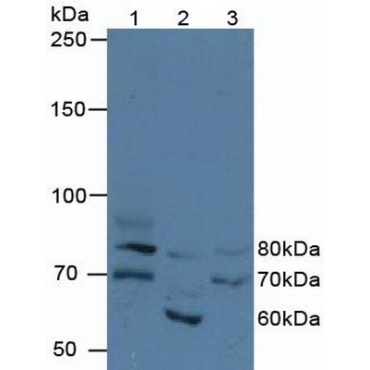 Fidgetin (FIGN) Human Polyclonal Antibody